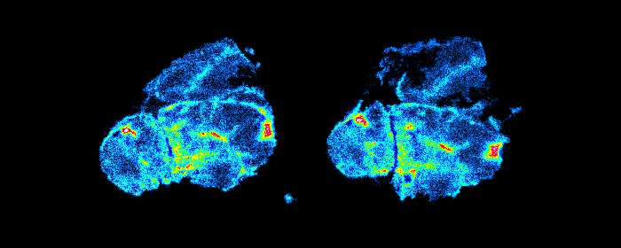 Autoradiography image of a tumor labelled with Zr89 Tumor labeled with 89Zr