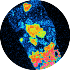 Real-time alpha autoradiography on Uraninite rock Presentation of a Real-time alpha autoradiography on Uraninite rock. Particularly used on geoscience field and mining field