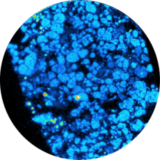 Presentation of a Real-time alpha autoradiography on Uraninite rock. Particularly used on geoscience field and mining field