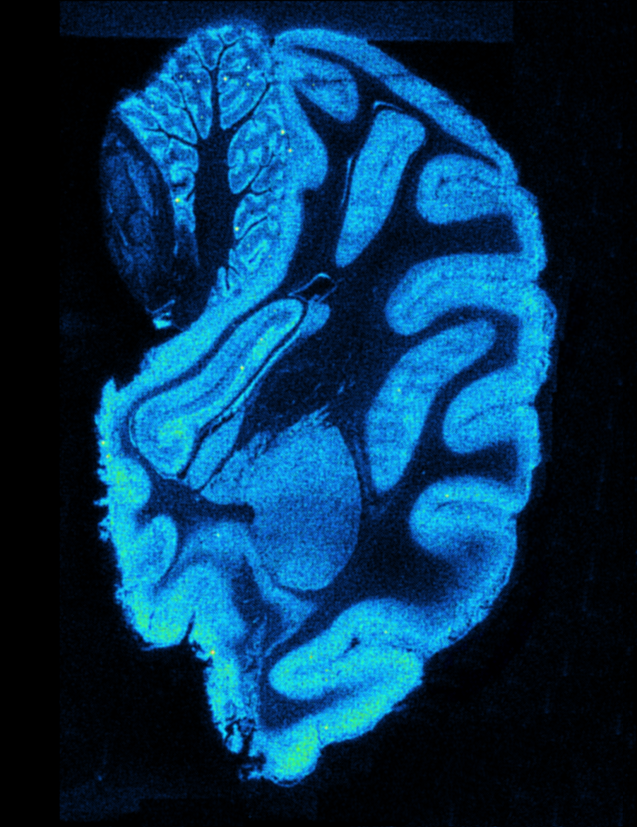 Autoradiography_Monkey_Brain